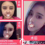 成都整形价格,全面了解整形费用与价值
